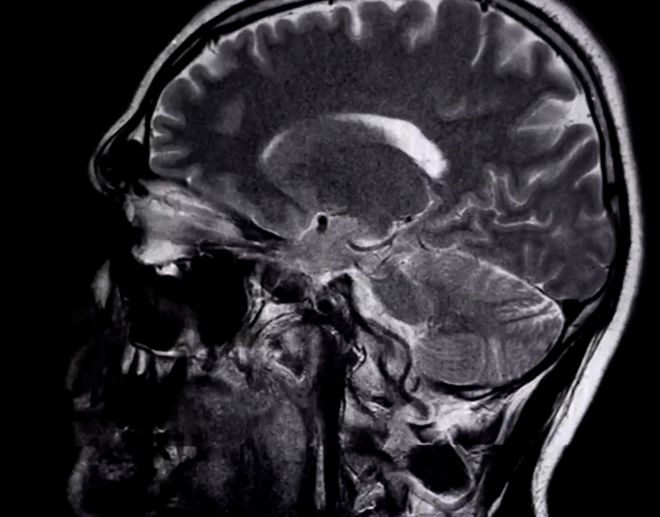 用脑电波操控无人机！这项“意念黑科技”如何让不可能变可能？